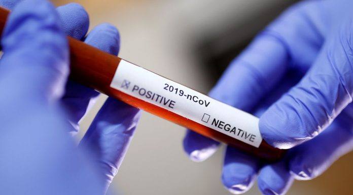 Wenceslau Braz bate a marca dos mil testes para Covid-19