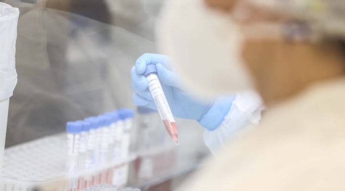 Município de Wenceslau Braz tem mais 23 novos casos de Covid-19