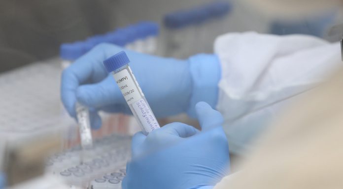 Amostras coletadas em Jacarezinho deram positivo para contaminação da Covid